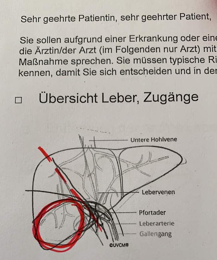Vorbesprechung Leberoperation